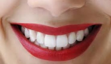 Understand More Facts About Dental Veneers.