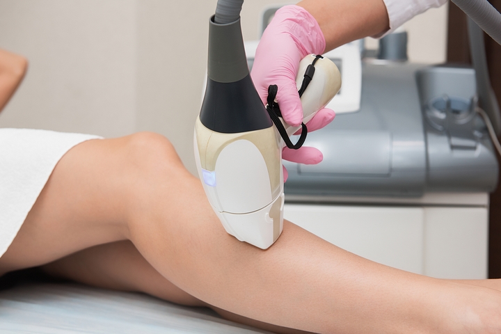 LASER HAIR REMOVAL TREATMENT