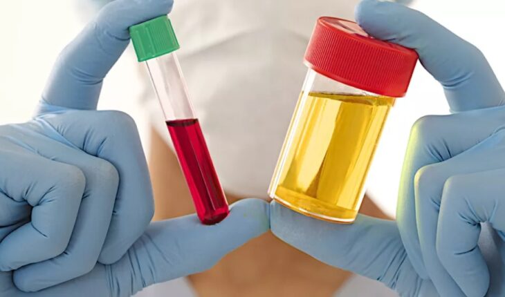 Are there any tips or tricks for ensuring the success of a synthetic urine test?