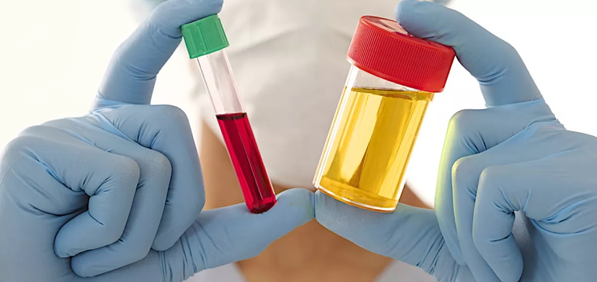 Are there any tips or tricks for ensuring the success of a synthetic urine test?